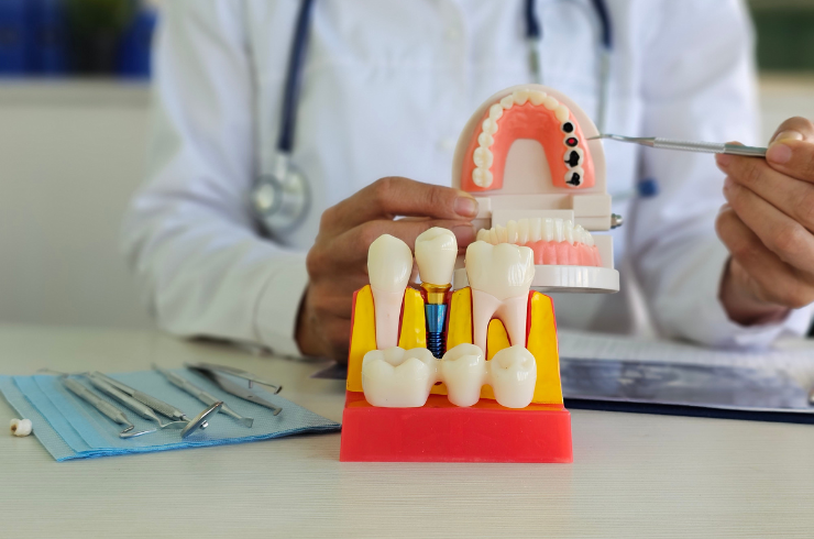 Prosthodontics - crowns and dentures